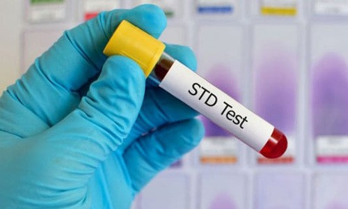 STD