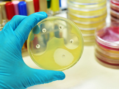 Urine Culture